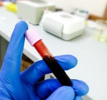 técnico segura tubo de lavanda com amostra de sangue para exame hematológico ou de sangue total. foto