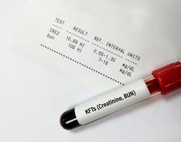 tubo de amostra de sangue isolado para creatinina e pão com relatório anormal para o diagnóstico de teste de função renal. foto