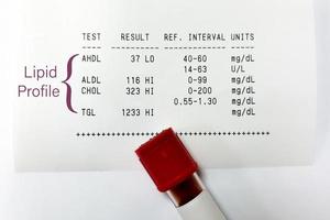 amostra de sangue isolada para teste de perfil lipídico com laudo anormal. foto