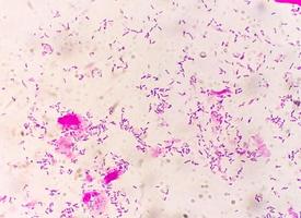 A coloração de gram, também conhecida como método de gram, é um método de diferenciação de espécies bacterianas em dois grandes grupos chamados gram positivos e gram negativos. foto