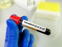 amostra de sangue para imunoglobulina, incluindo iga, ige, igg, teste igm, diagnóstico de doença de imunodeficiência. foto