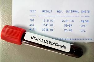 amostra de sangue isolada para teste de função hepática ou lfts incluindo alt, ast e bilirrubina total com relatório anormal do paciente. foto