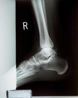 tornozelo pés e joelho dor nas articulações raio-x humano filme de ressonância magnética