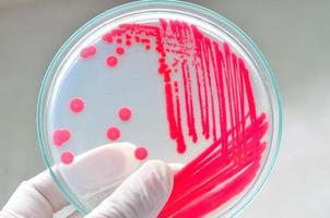 placa de Petri com bactérias foto