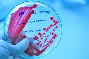 placa de Petri com colônia vermelha de bactérias foto
