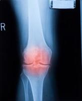tornozelo pés e joelho dor nas articulações raio-x humano filme de ressonância magnética