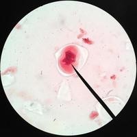 células vivas saudáveis (mitose) foto