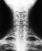 imagem de raio-x das vértebras cervicais
