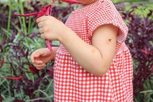 linda menina asiática tem erupção cutânea e alergia por picada de mosquito e chupando sangue enquanto brinca ao ar livre foto