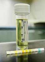 amostra de urina com tira de teste. foto