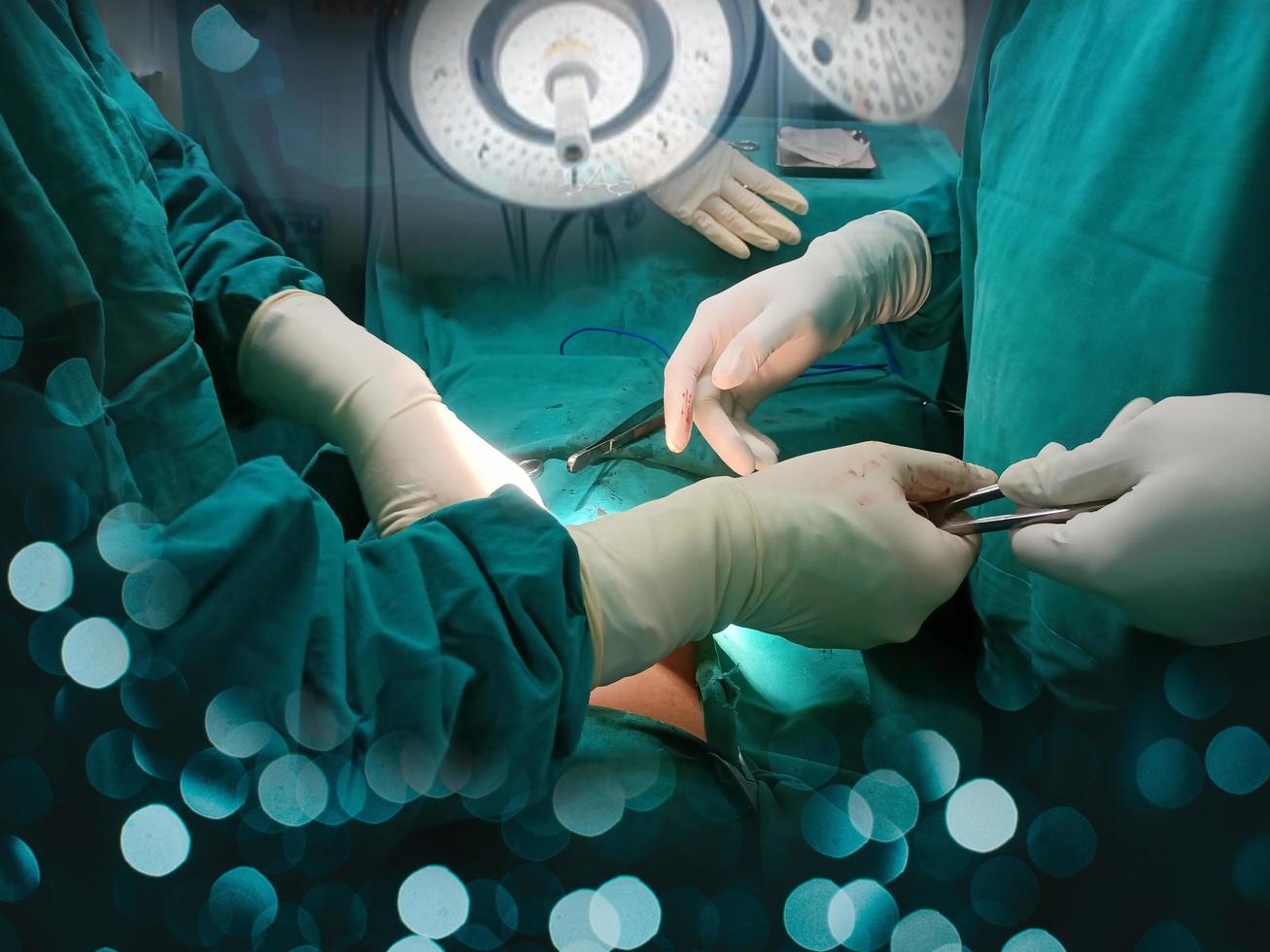 Hand des medizinischen Teams, das im modernen Operationssaal einen chirurgischen Eingriff durchführt. foto
