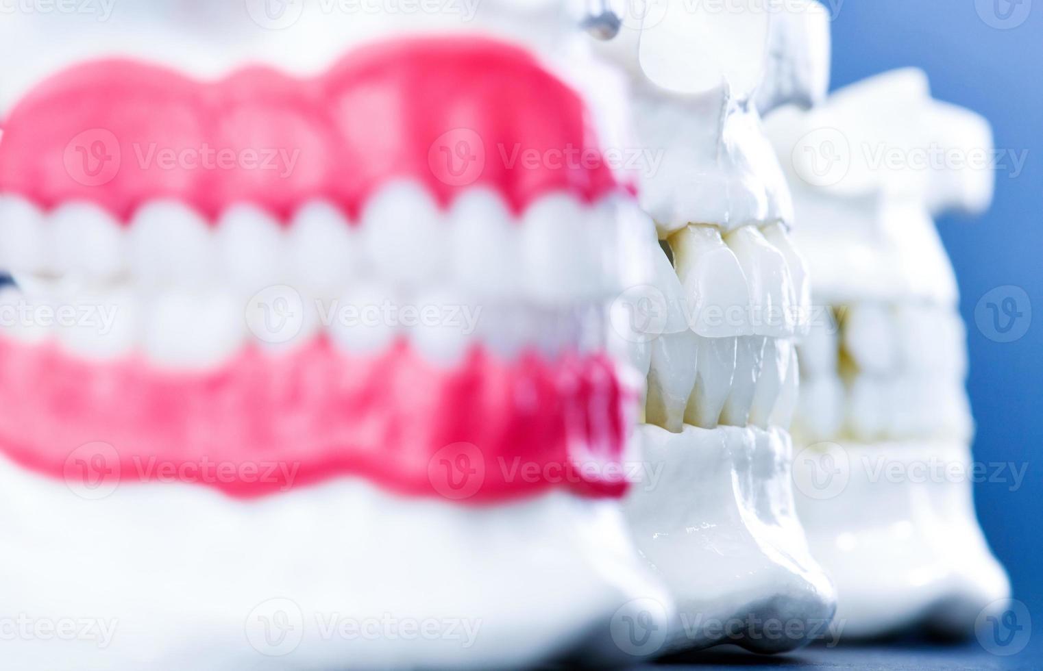 menschliche Kiefer mit Zähnen und Zahnfleischanatomiemodellen foto