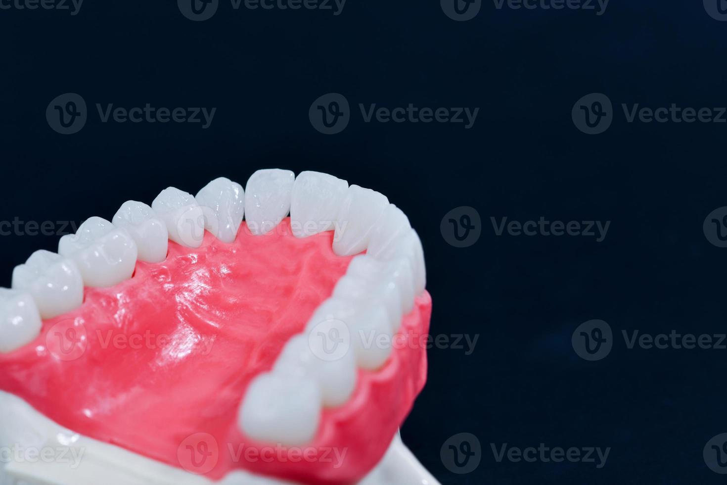 menschlicher Oberkiefer mit Zähnen und Zahnfleisch Anatomiemodell foto