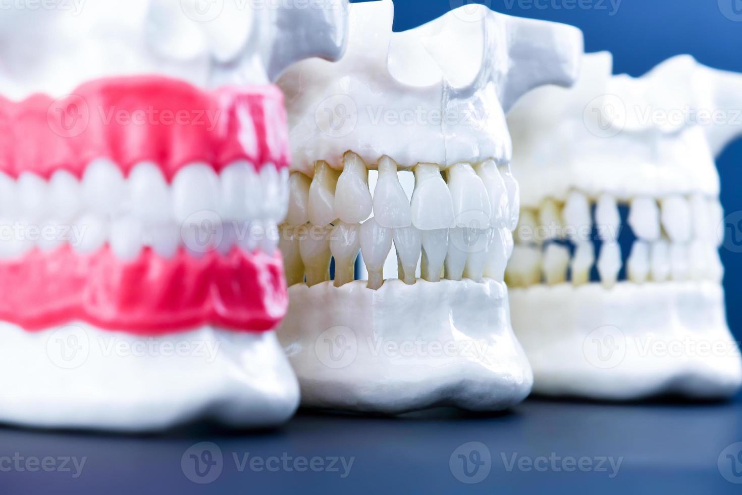 menschliche Kiefer mit Zähnen und Zahnfleischanatomiemodellen foto