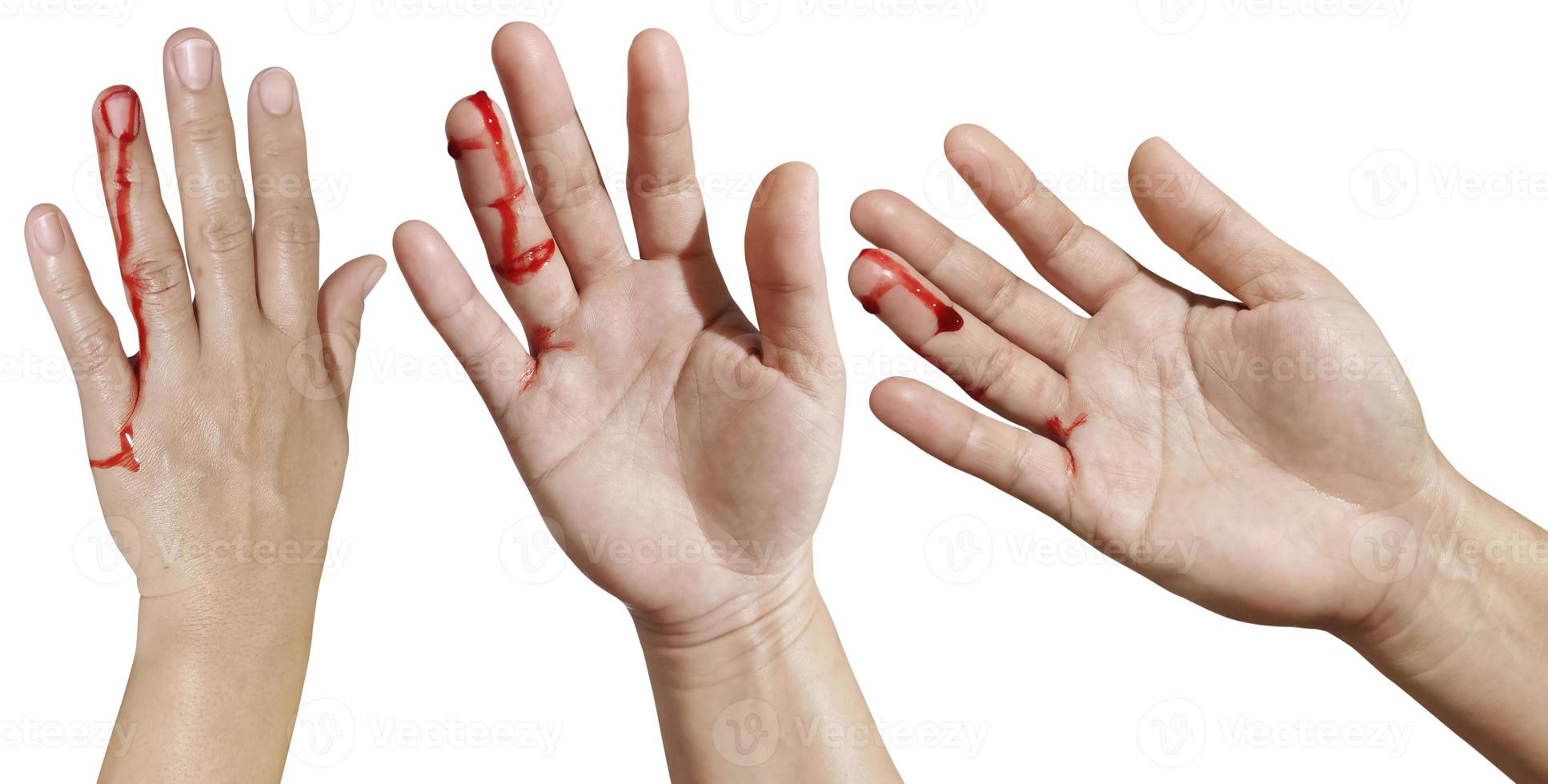 Die Hand der blutigen Frau stellt Verletzungen, Unfälle auf weißem Hintergrund dar foto