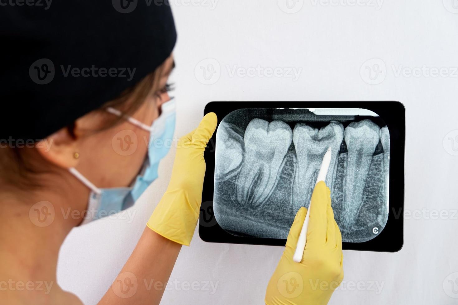 Das Röntgenbild zeigt eine alte junge männliche Frau und erklärt das Verfahren foto