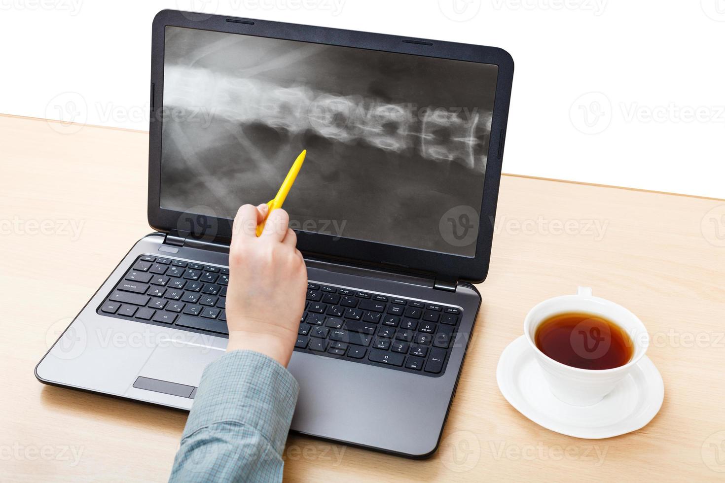 sanitäter analysiert das röntgenbild der wirbelsäule auf dem laptop foto