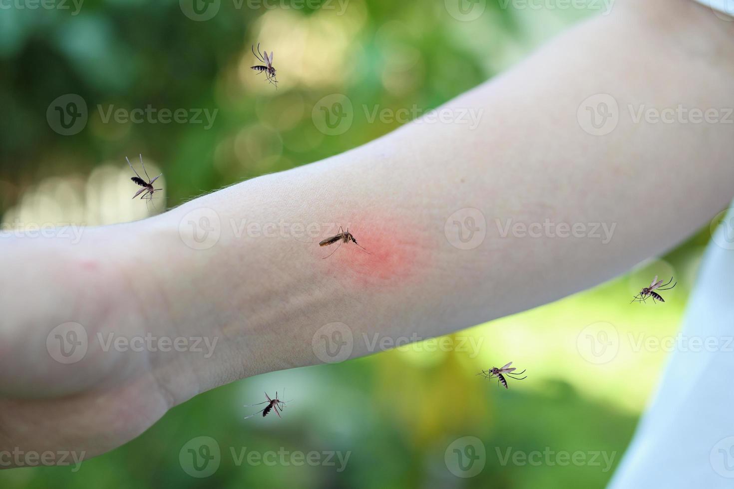 Mückenstich am Arm eines Erwachsenen mit Hautausschlag und Allergie mit rotem Fleck foto