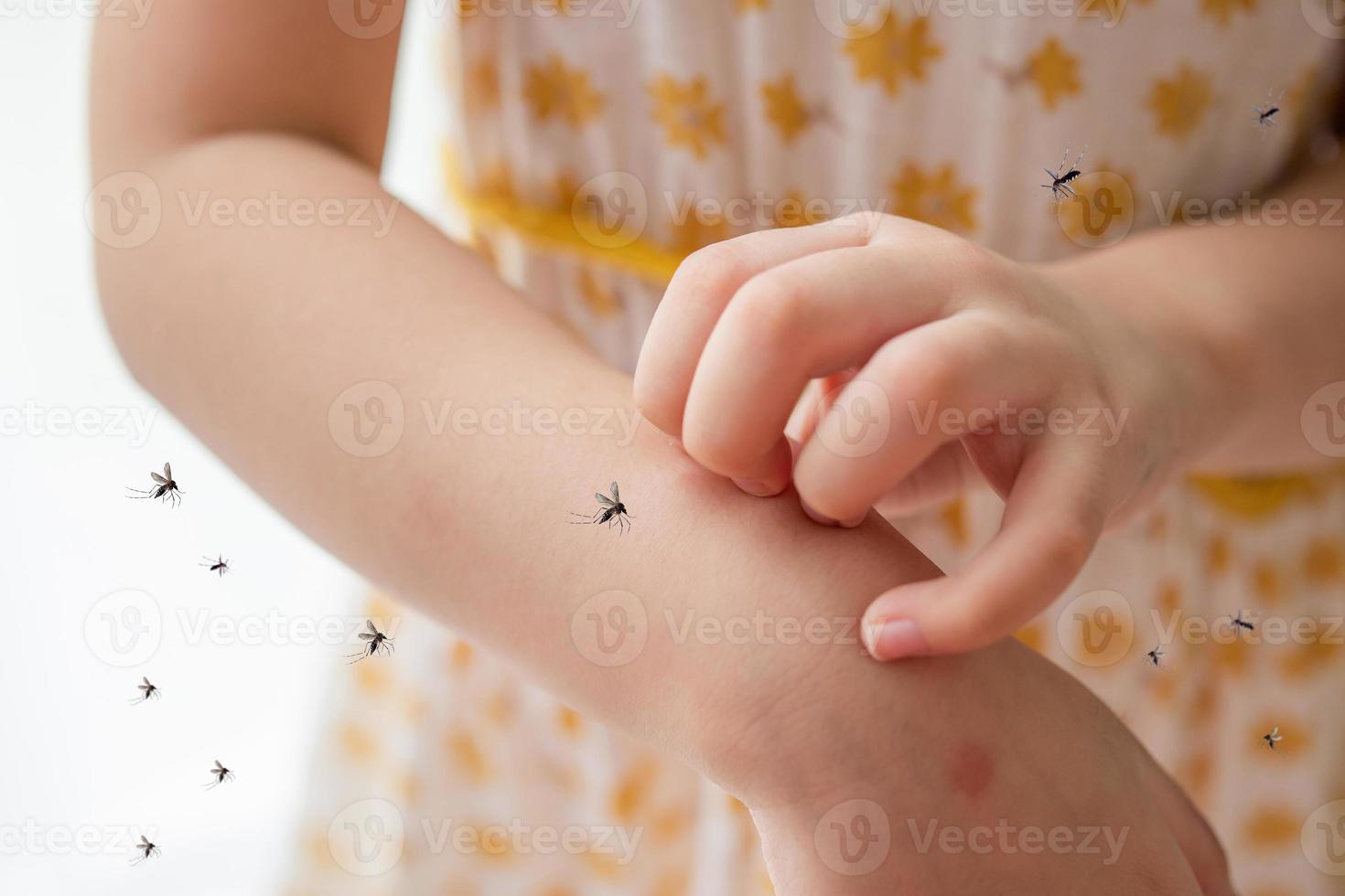 Kleines Mädchen hat Hautausschlagallergie und Juckreiz am Arm durch Mückenstich foto