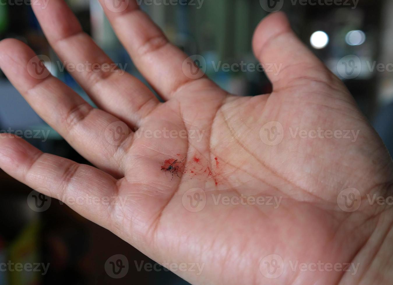 tote Mücke mit rotem Blut auf der menschlichen Handfläche foto