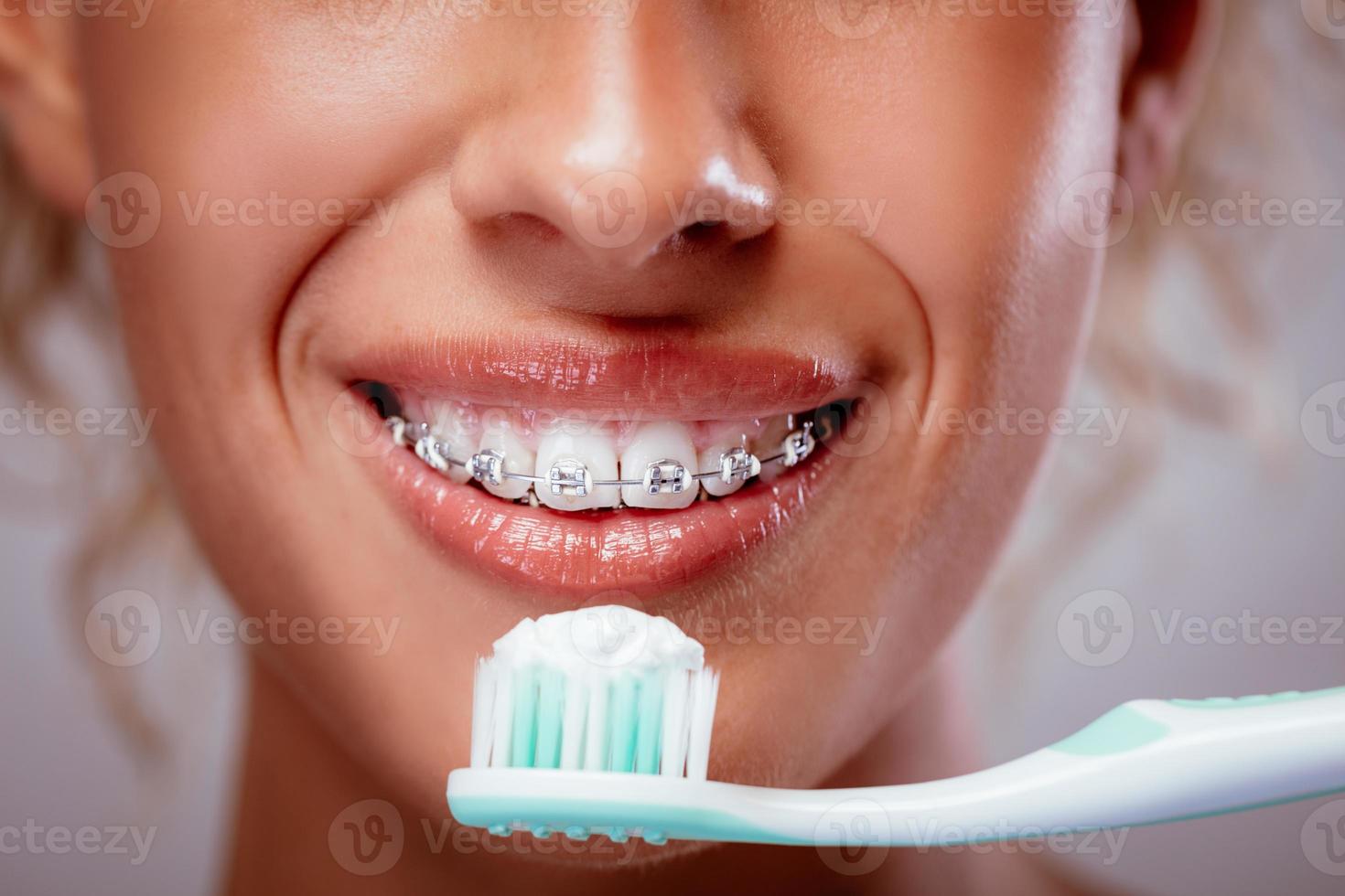Zähneputzen mit Zahnspange foto