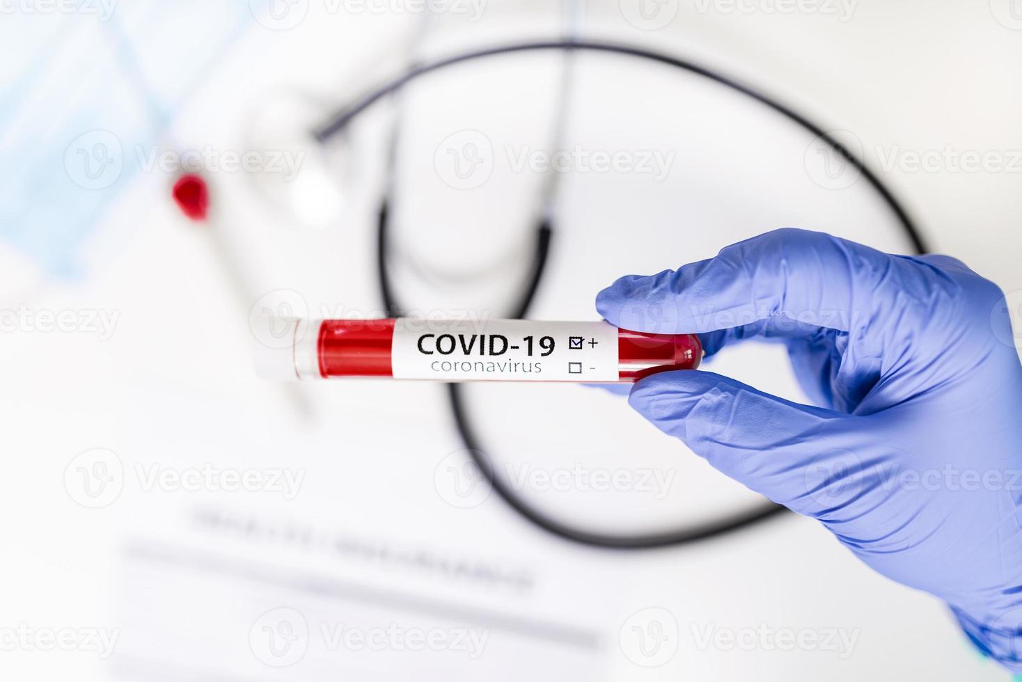 labortechniker halten blutprobenröhrchen für corona-virus-test, covid 19-test foto