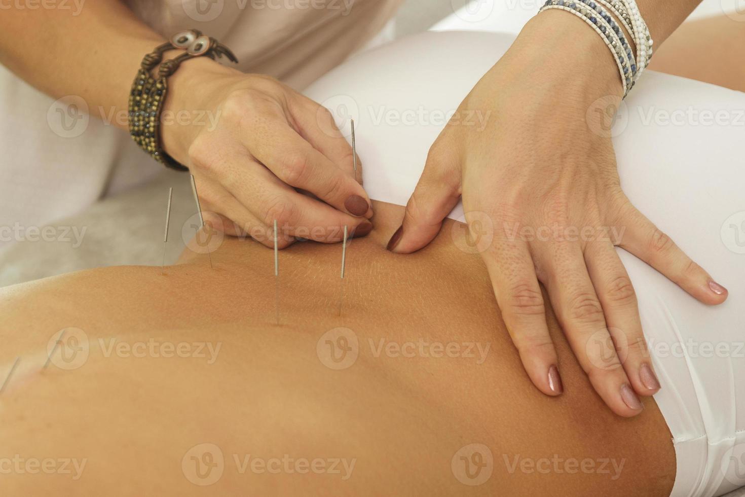 Meister injiziert Stahlnadeln während des Verfahrens der Akupunkturtherapie foto