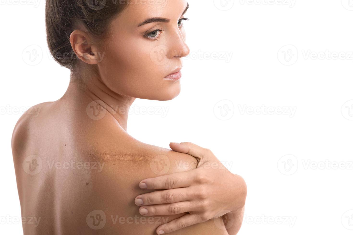 Frau mit einer Narbe auf der Schulter foto