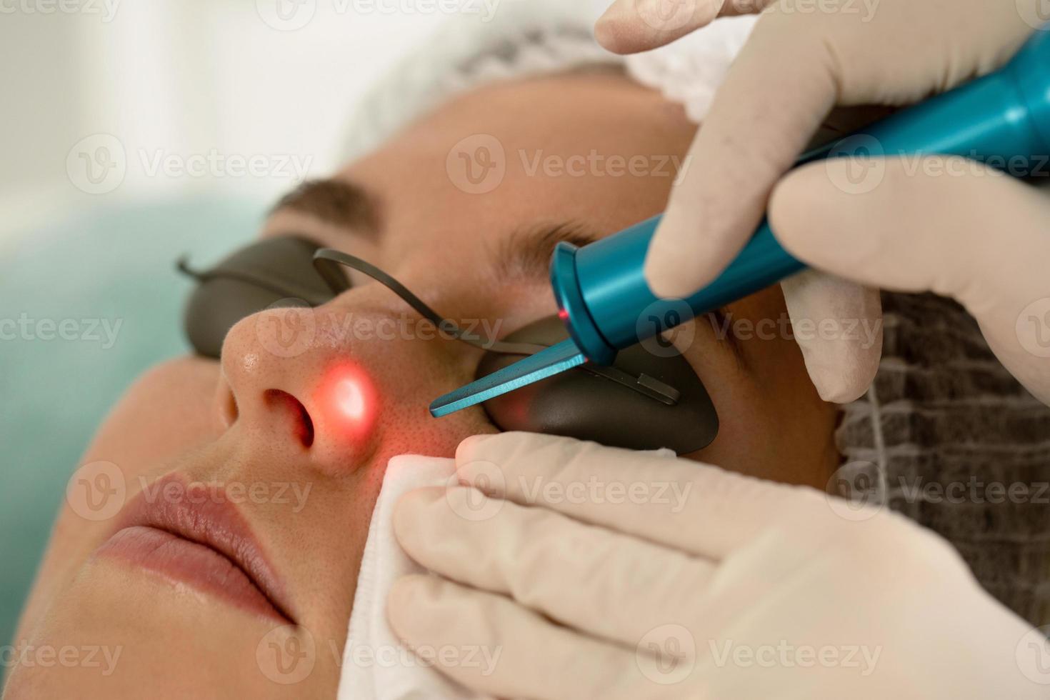 Frau während der Entfernung von Lasermolen in einer medizinisch-ästhetischen Klinik foto