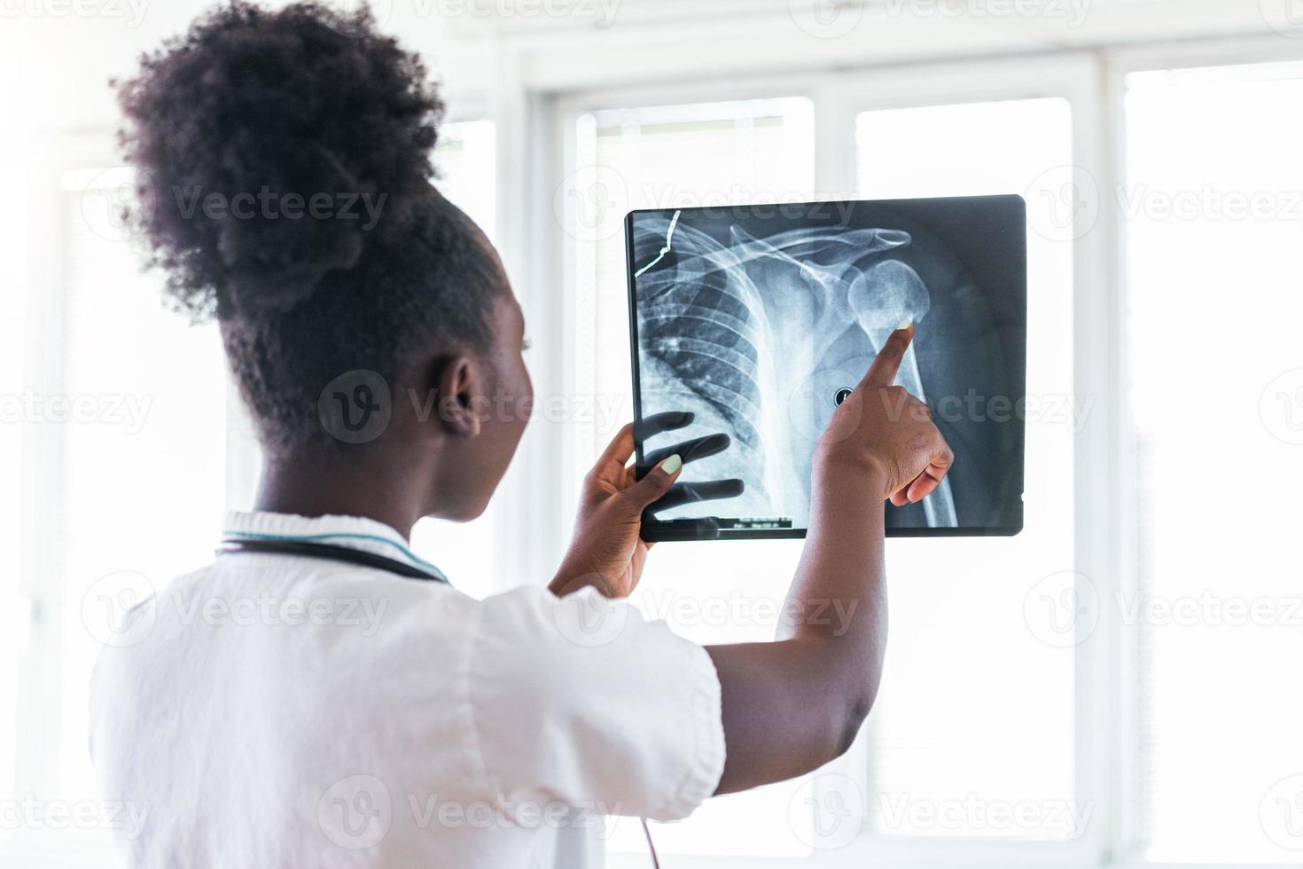 röntgenfilmbild mit arzt für medizinische und radiologische diagnose der weiblichen patientengesundheit bei krankheiten und knochenkrebserkrankungen, gesundheitskrankenhausservicekonzept foto