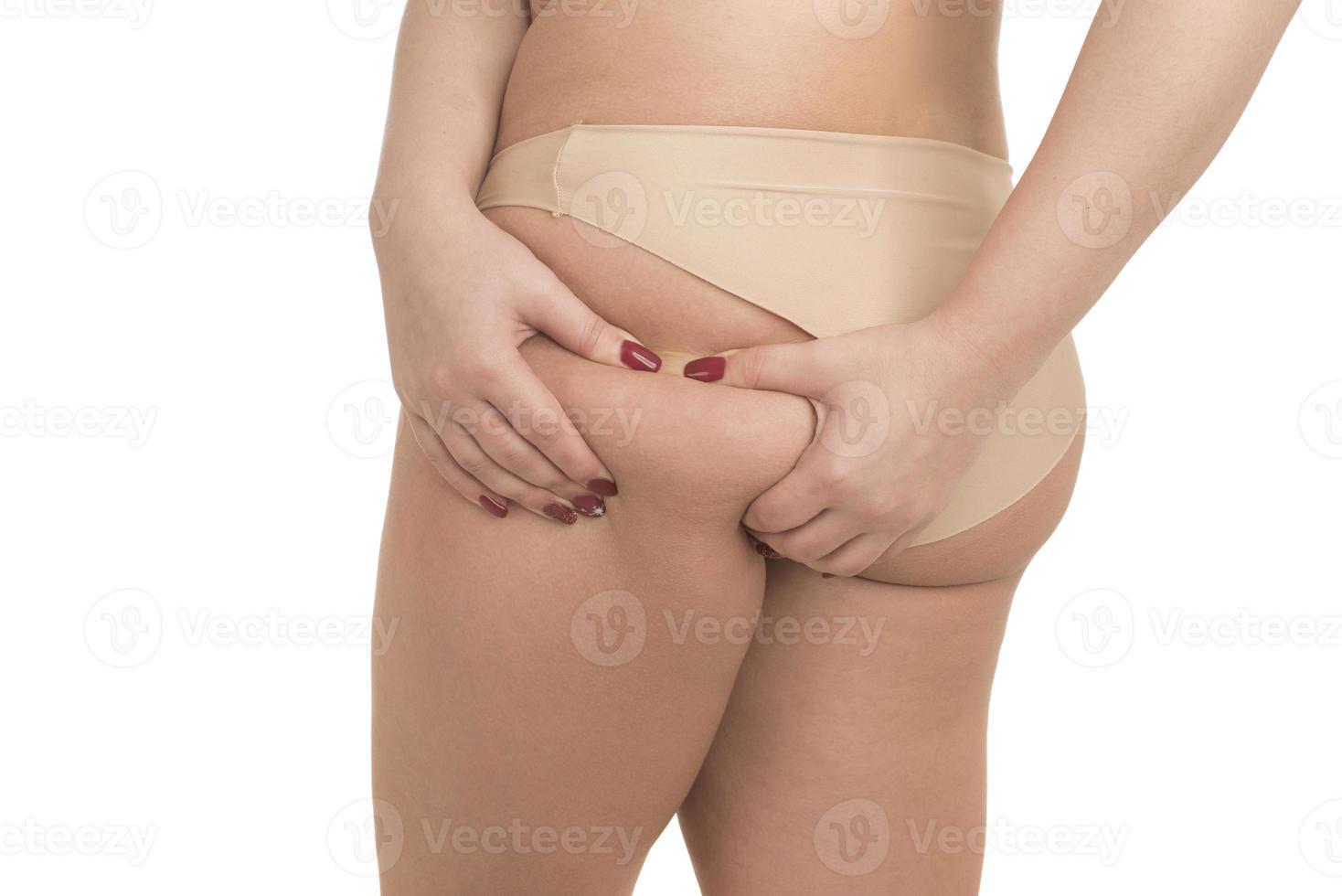 Übergewichtige Frau mit dicken Oberschenkeln, Fettleibigkeit bei Frauen foto