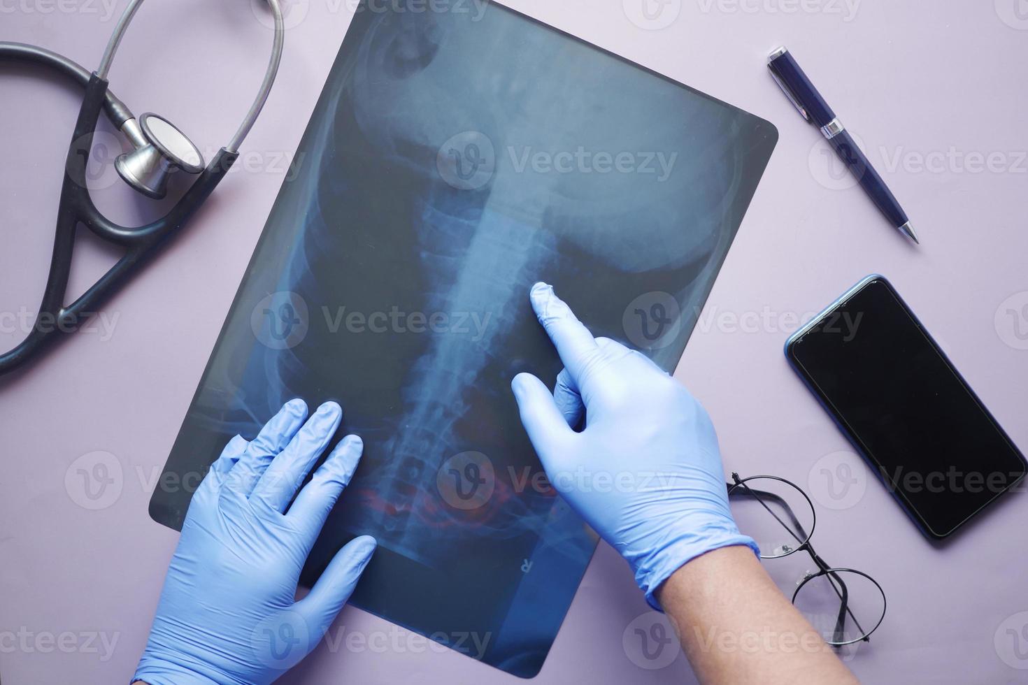 Arzt halten Analyse von Röntgenaufnahmen, Nahaufnahme foto