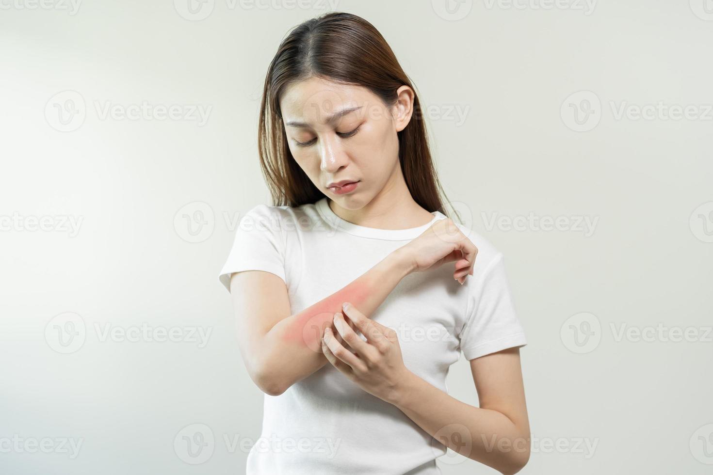 Dermatologie asiatisch jung Frau, Mädchen Allergie, allergisch Reaktion von atopisch, Insekt beißt auf ihr Arm, Hand im Kratzen juckend, jucken rot Stelle oder Ausschlag von Haut. Gesundheitspflege, Behandlung von Schönheit. foto