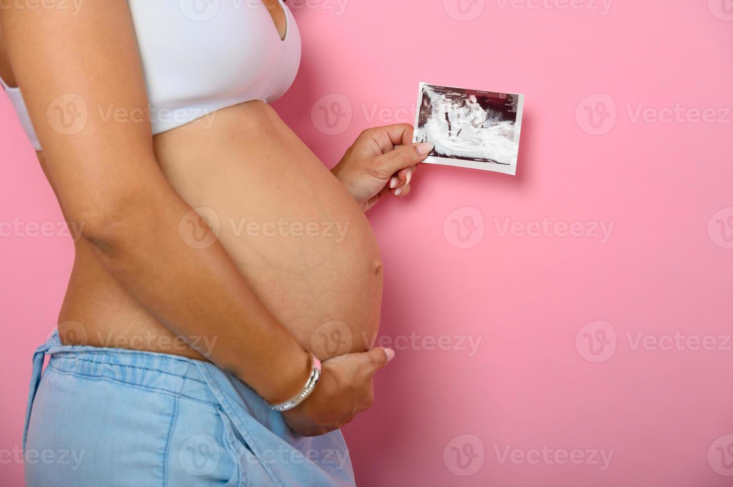 schwanger Mama zeigt an ein Ultraschall von ihr Sohn foto