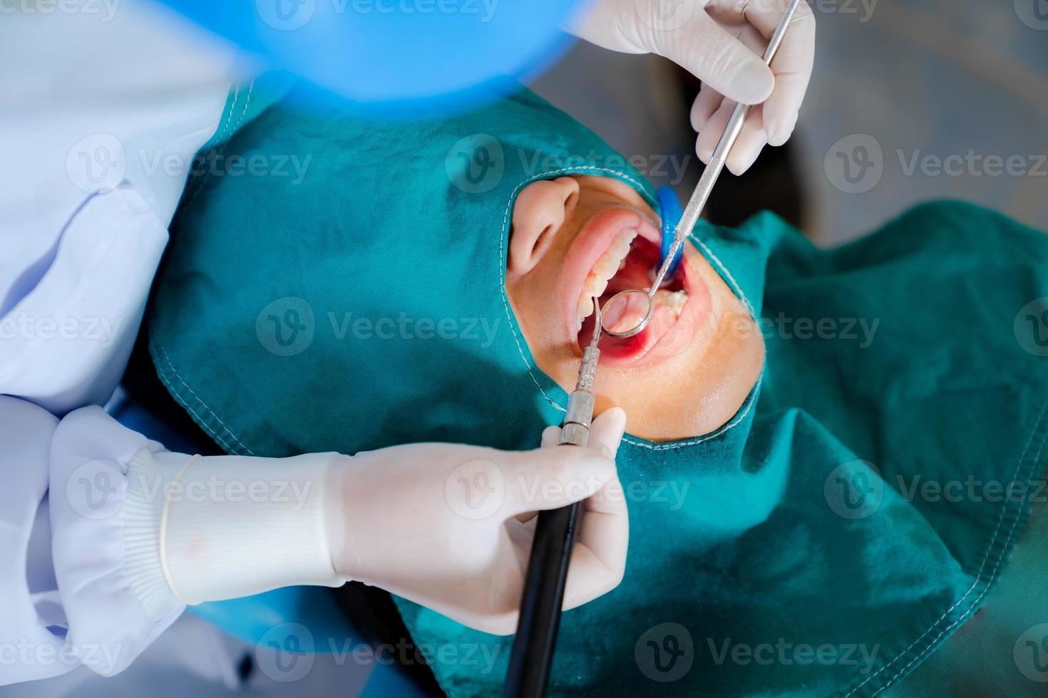 Zahnärztin, die in der Zahnarztpraxis steht, arbeitet mit lichthärtender Versiegelung foto