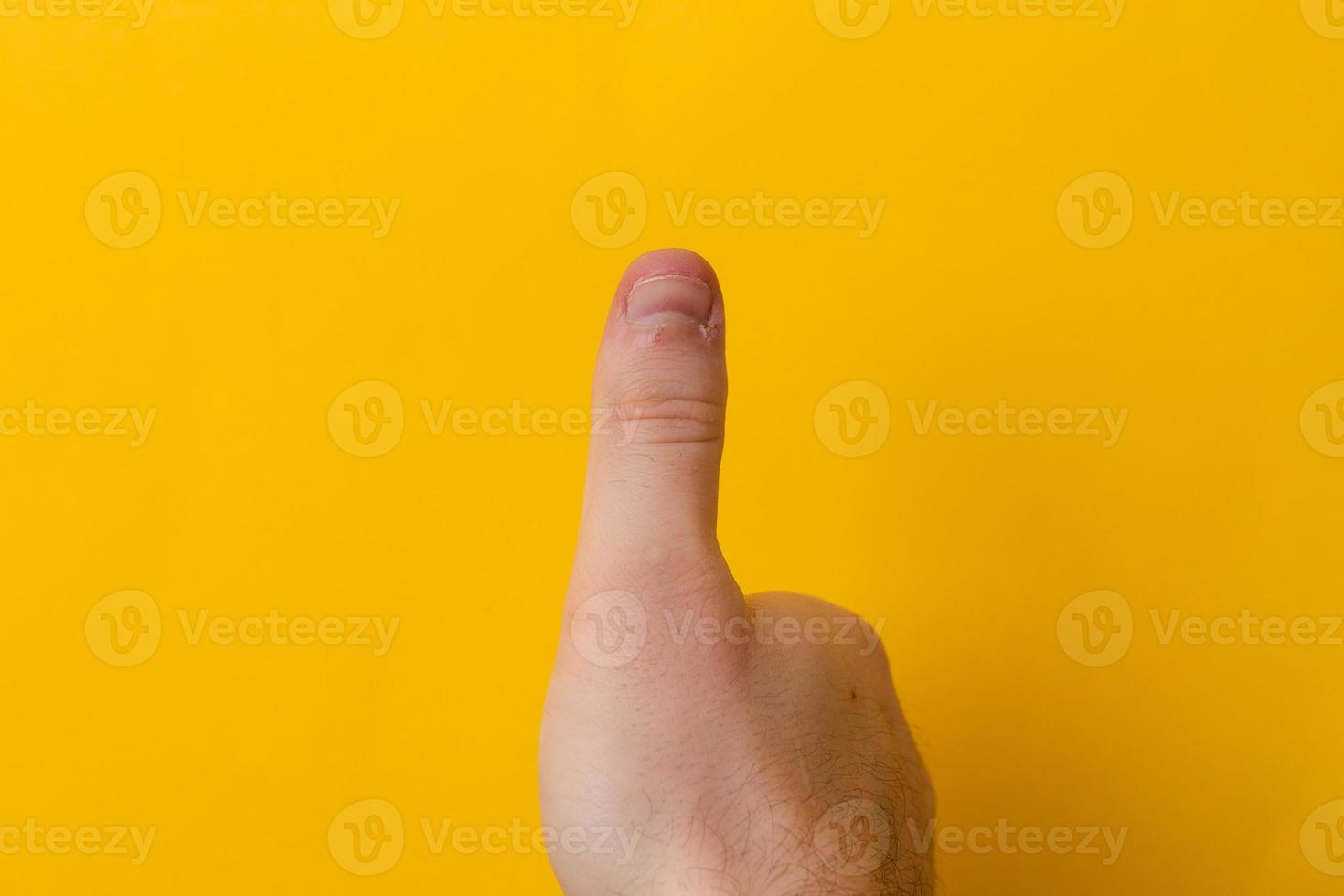 Finger mit gebissenen Nägeln lokalisiert auf gelbem Grund foto