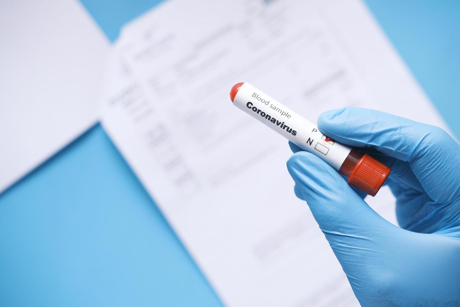 Hand in blauen medizinischen Handschuhen mit Blutteströhrchen und medizinischem Bericht auf dem Tisch foto