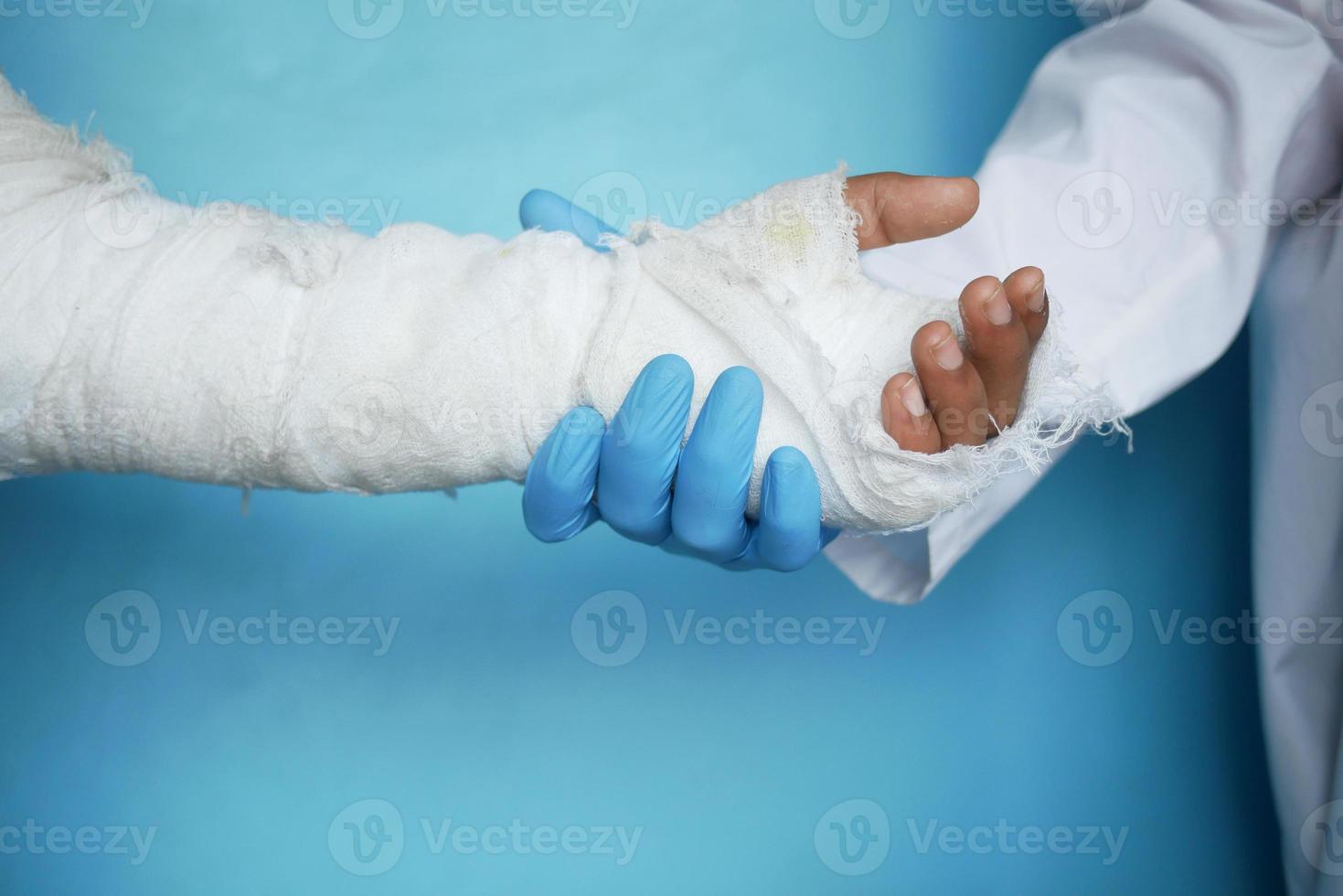 Arzthand in Handschuhen hält verletzte schmerzhafte Hand mit Verband band foto