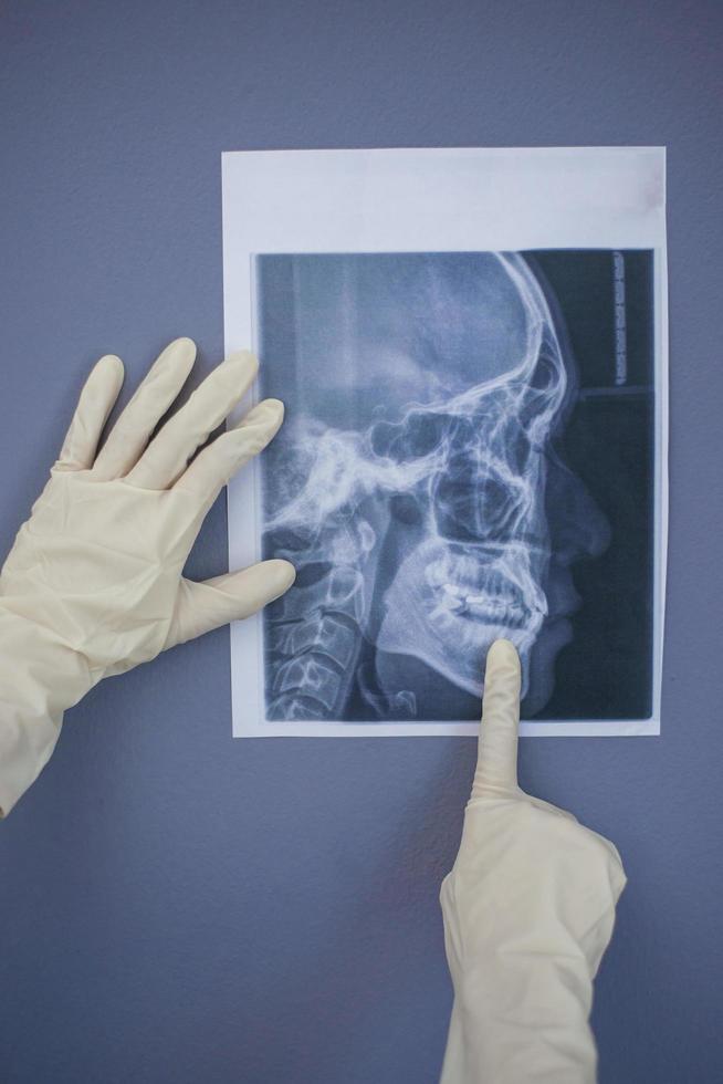 Zahnärztin, die ein Zahnröntgen hält foto