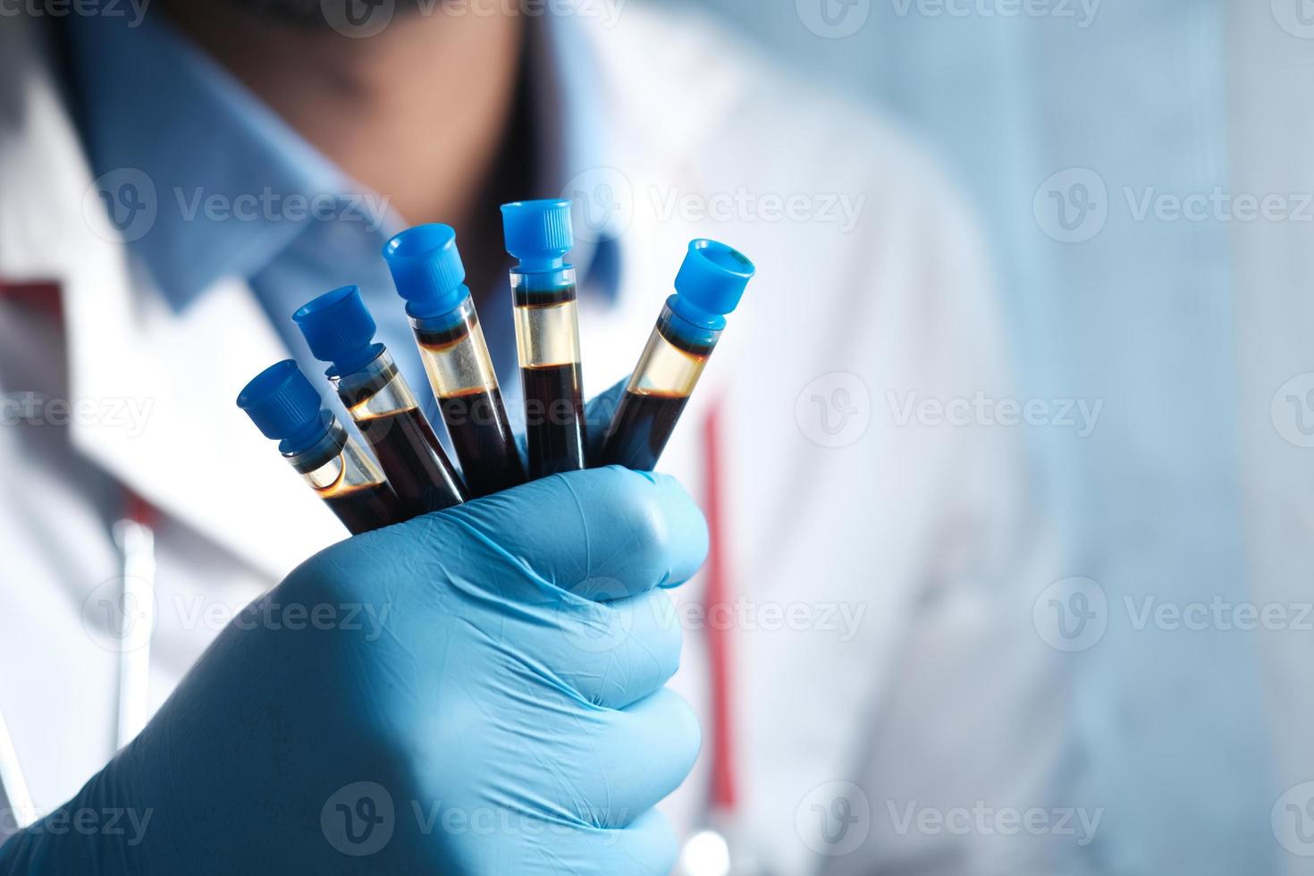 Hand in blauen medizinischen Handschuhen, die ein weißes Blutteströhrchen halten foto