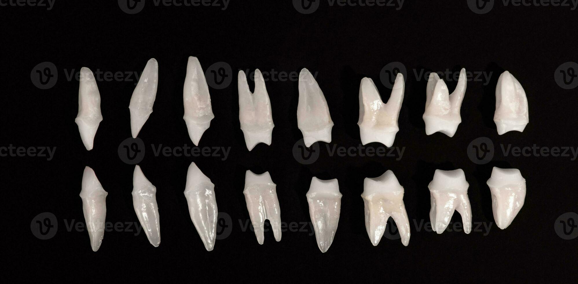 Prothese Zahnheilkunde Weiß Zähne auf schwarz Hintergrund Oral Dental Hygiene Dental Gesundheit Konzept Oral Pflege Zähne Wiederherstellung oben Sicht. foto