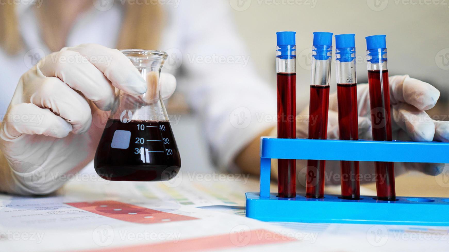 Hand eines Wissenschaftlers, der ein Blutprobenröhrchen vom Stand nimmt foto