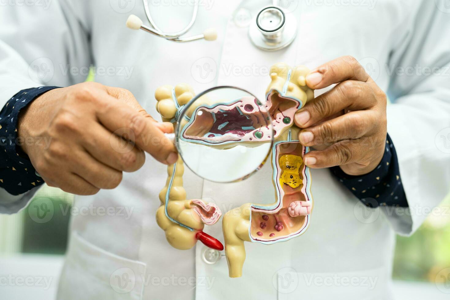 Darm, Blinddarm und Verdauungs- System, Arzt halten Anatomie Modell- zum Studie Diagnose und Behandlung im Krankenhaus. foto