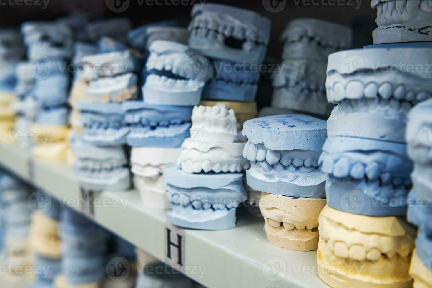 Warenhaus von Gips Modelle von Mensch Kiefer im ein kieferorthopädisch Klinik. Steuerung und Diagnose Dental Abgüsse zum Aligner. foto