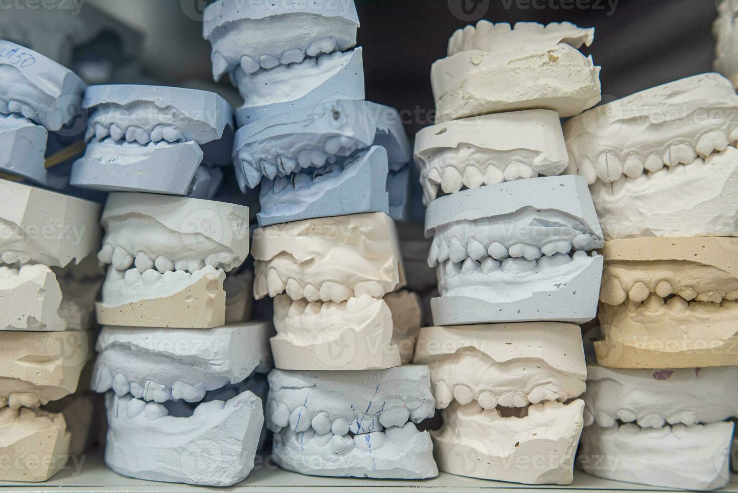 Warenhaus von Gips Modelle von Mensch Kiefer im ein kieferorthopädisch Klinik. Steuerung und Diagnose Dental Abgüsse zum Aligner. foto