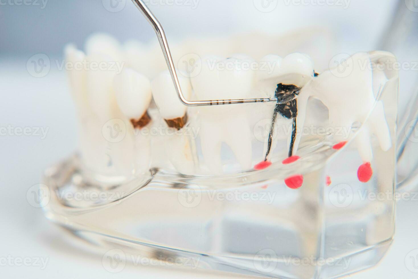 Arzt Kieferorthopäde zeigt an das Instrument auf Karies im das Zähne foto