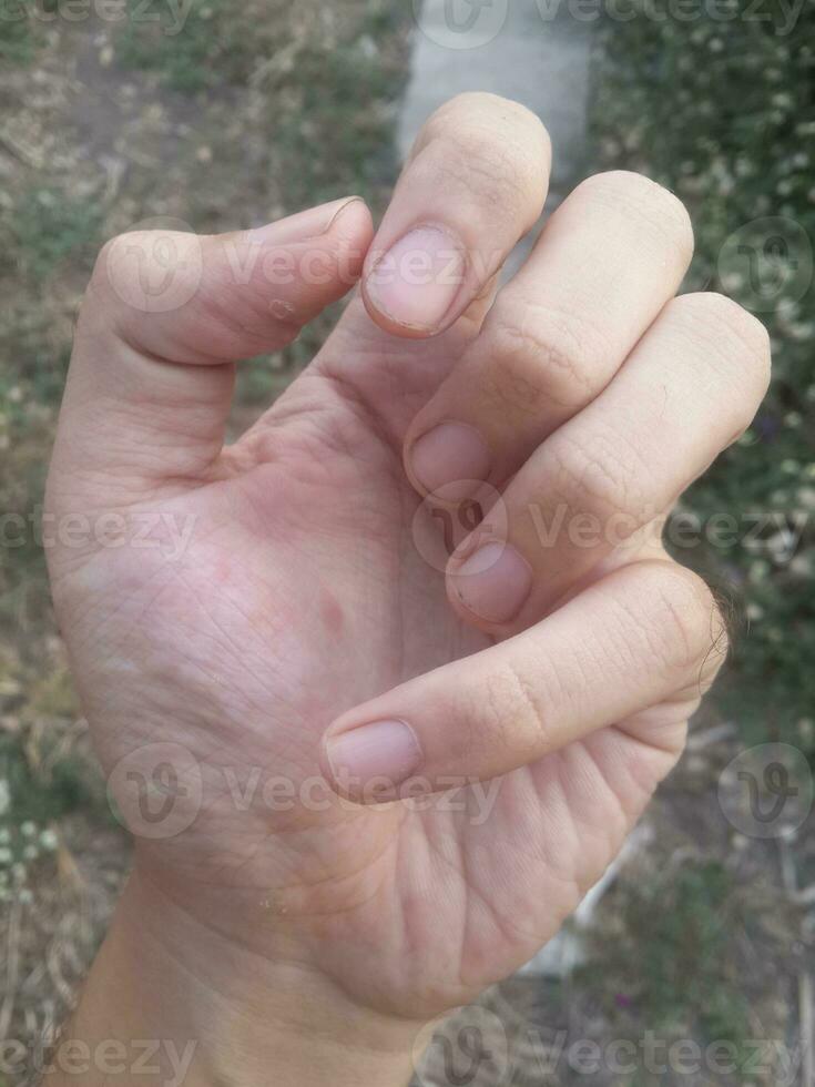 Hand mit ein Weiß Nagel foto
