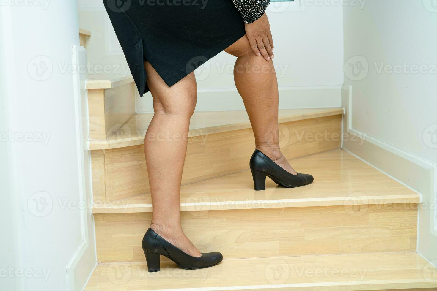 asiatisch Frau geduldig fallen Nieder das Treppe weil rutschig Oberflächen. foto