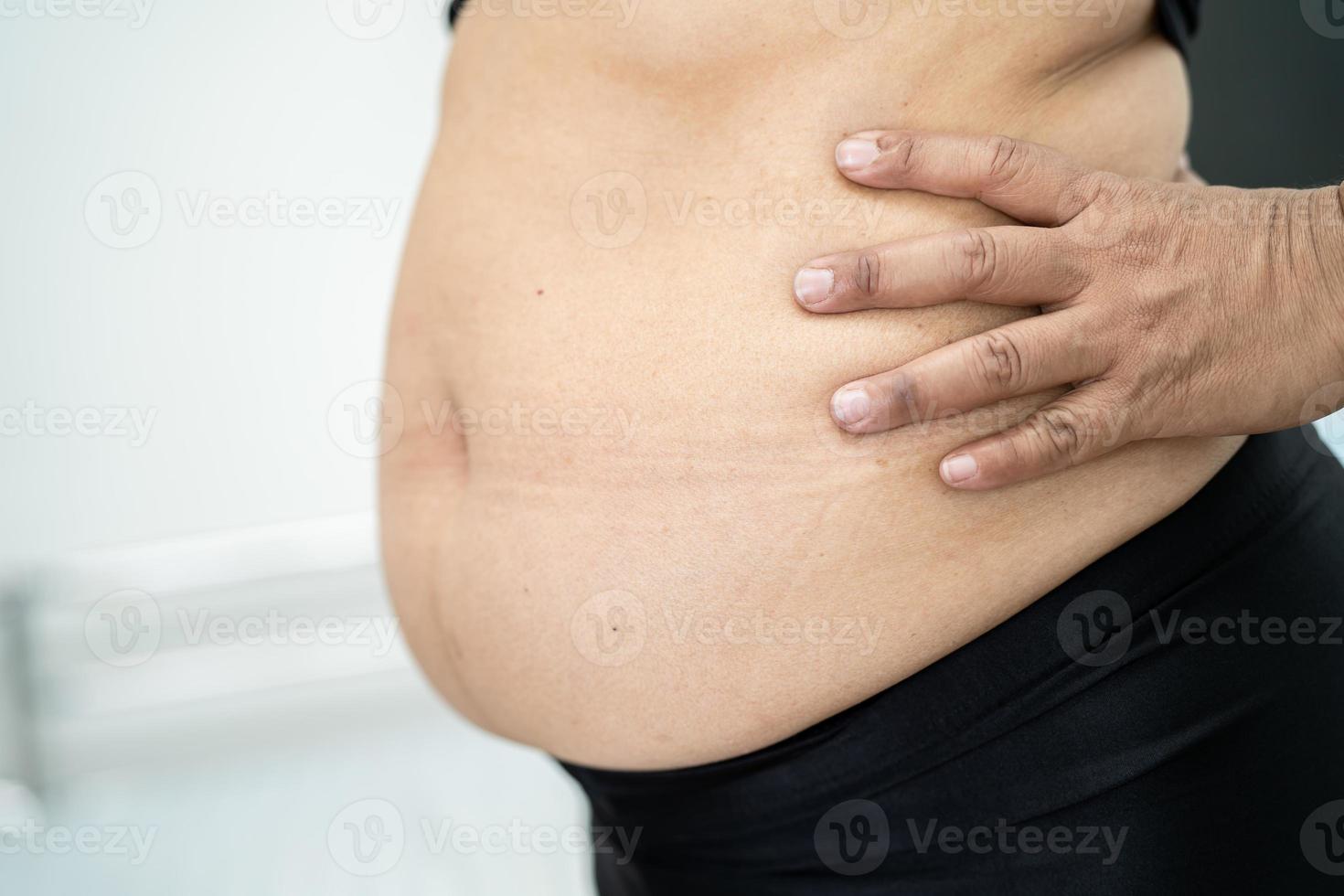 Übergewichtige Asiatin zeigt fetten Bauch im Büro. foto