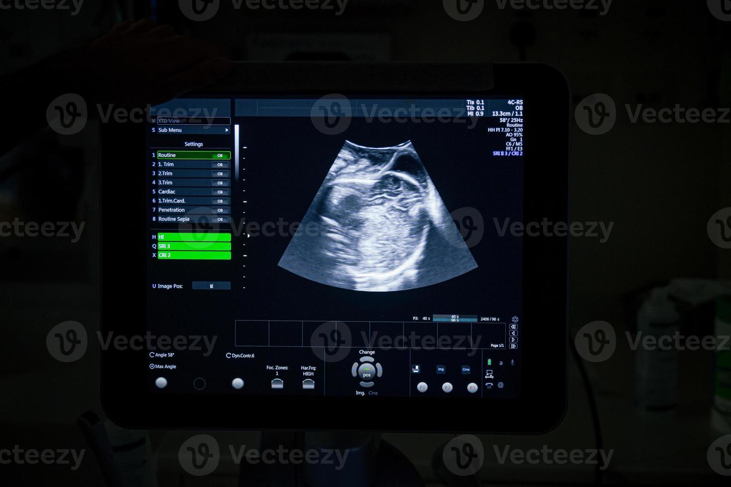 medizinisches Ultraschallgerät mit einem 4D-Bild in einem Arbeits- und Kreißsaal in einem Krankenhaus foto
